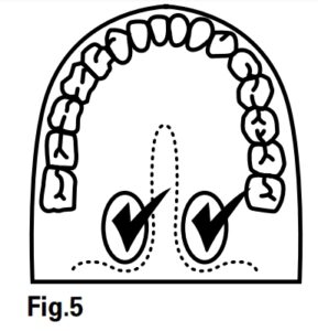 Diagram of mouth showing best place to put thermometer