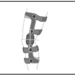 DJO DONJOY OA Fullforce Knee Brace Manual Image